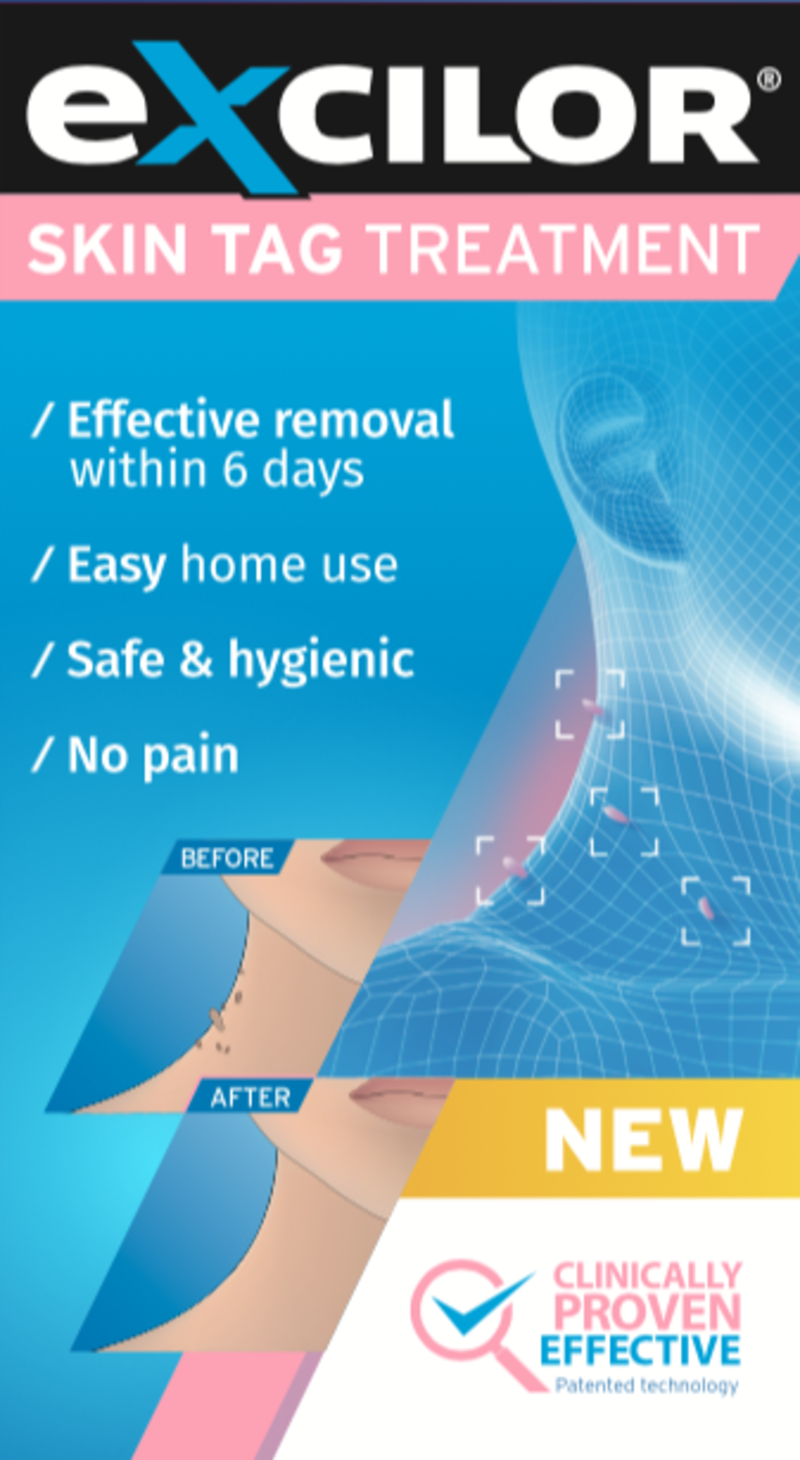 EXCILOR skin tag treatment